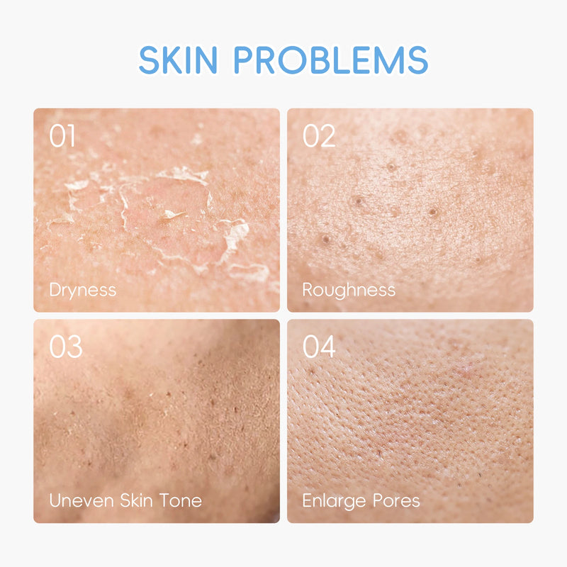 Kit Trio LAIKOU Milk: Nutrição Profunda, Sérum Hidratante, Clareador de manchas