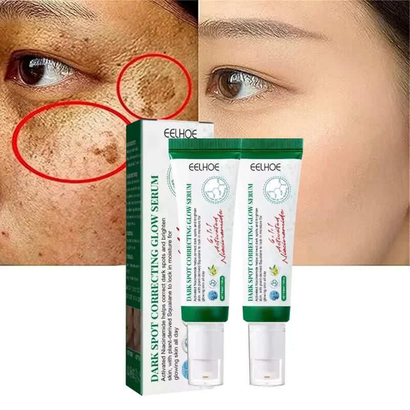 Creme Corretor de Manchas Escuras, Reduz Manchas e Hidrata a pele