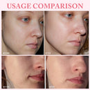 10 PÇS/BOX Sérum Diário, redução de oleosidade, reparação da pele e clareador