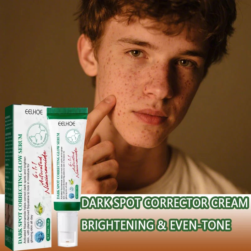 Creme Corretor de Manchas Escuras, Reduz Manchas e Hidrata a pele