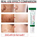 Creme Corretor de Manchas Escuras, Reduz Manchas e Hidrata a pele