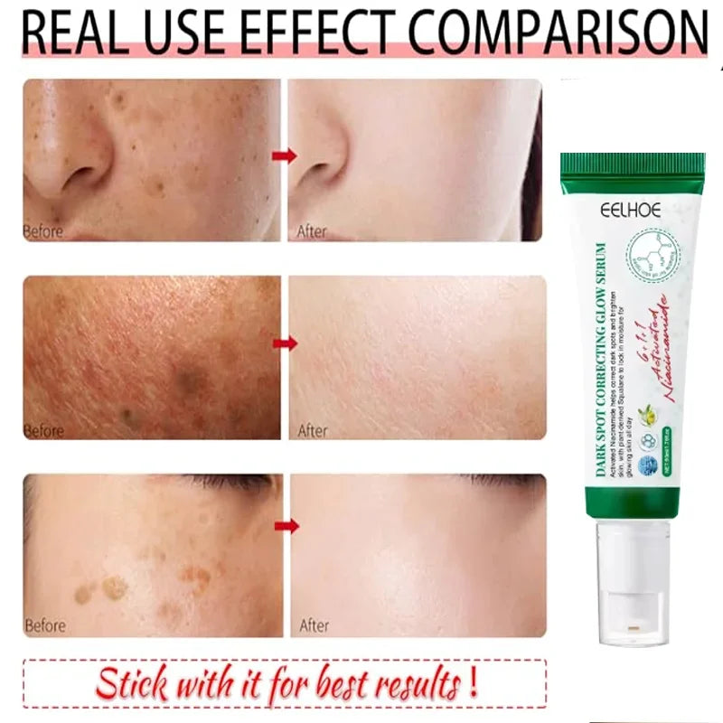 Creme Corretor de Manchas Escuras, Reduz Manchas e Hidrata a pele